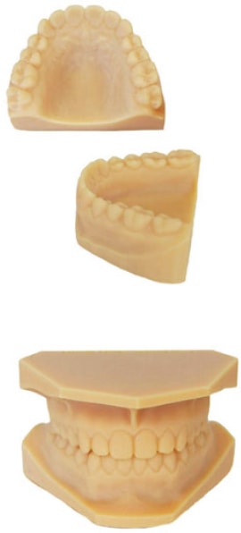 (top) Palate and lingual anatomy; (bottom) Low profile model